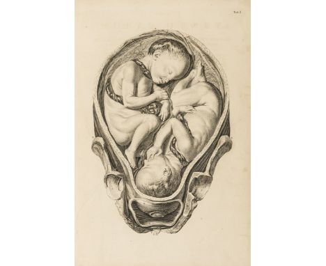 Smellie (William) A sett of anatomical tables, with explanations, and an abridgment of the practice of midwifery, first editi