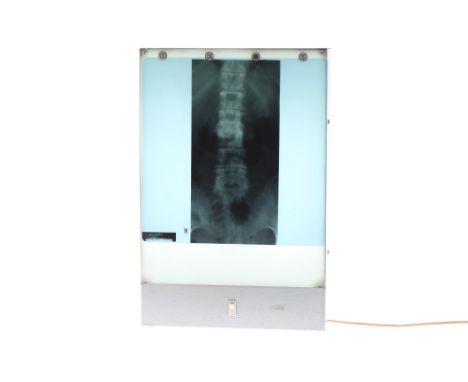 X-Ray Light Box Perfect for any Budding doctor - also makes an interesting lamp, constructed of metal plate with a white pers