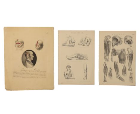 Medicine - A Small Folio of Medical &amp; Surgical Book Plates, comprising of several medical plates of surgical instruments 