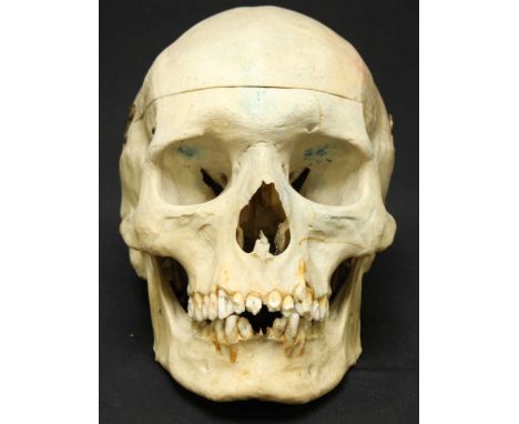 A medical human skull, with cut cranium and sprung hinged lower jaw.