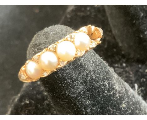 An 18ct pearl ring (stone missing)