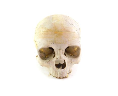 A human skull, in two sections, and lacking lower jaw.