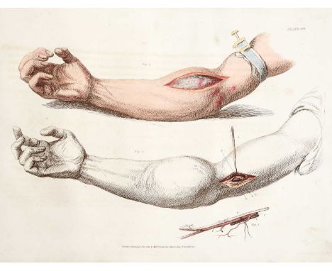 Bell (Charles).Illustrations of The Great Operations of Surgery, Trepan, Hernia, Amputation, Aneurism, and Lithotomy.Longman,