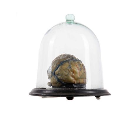 WAX MEDICAL MODEL OF A HUMAN BRAIN LATE 19TH/EARLY 20TH CENTURY presented on ebonised base beneath glass bell jar