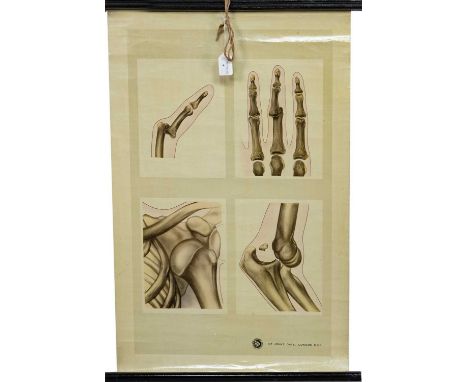 EARLY 20TH CENTURY MEDICAL ROLLER CHART DEPICTING VARIOUS DISLOCTIONS for St John's Ambulance Association by J. Teck80cm x 61