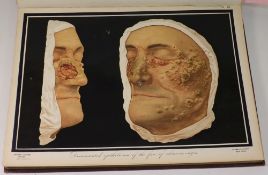 PRINGLE, J.J. - A Pictorial Atlas of Ski