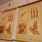 A pair of vintage St John's Ambulance students wall charts displaying examples of fractures and