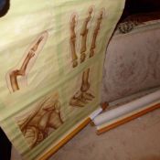 A pair of vintage St John's Ambulance students wall charts displaying examples of fractures and