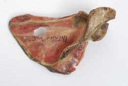A Victorian human scapula (shoulder blade). Profusely annotated with medical notation.
