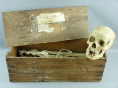 A HUMAN SKULL & PART SKELETON, the skull with sprung jaw and cut and clipped cranium, in an original