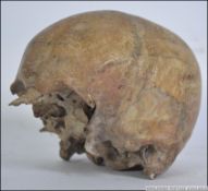 An early 20th century Human scull - Cranium being given to the vendor in the mid 20th century