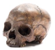 A 19th century human skull together with a later 20th century composition skeleton:,