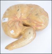 A 20th century medical model of a human stomach split onto two halves. Measures 25cms wide.