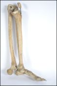 A rare antique Victorian medical sample of a human leg and foot. With kneecap mounted separately.