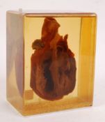A 20th century medical / hospital display ' real ' human heart being set within perpex cased with