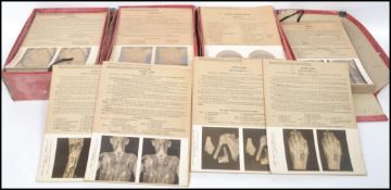 STEREOVIEWS ANATOMY The Edinburgh Stereoscopic Atlas of Anatomy by Waterson & Burnet. The New