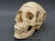 A human skull for medical teaching, with sliced cranium and a sprung articulated lower jaw.