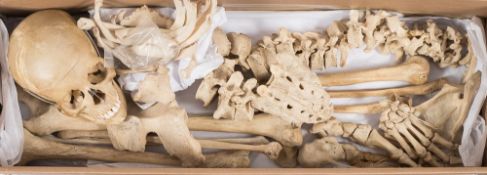 Homo Sapien an articulated part skeleton:, the skull with sprung jaw, spine and sacrum,