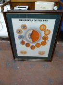 *Disorders of the Eye Chart