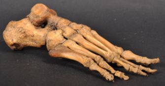 ANATOMICAL INTEREST - VICTORIAN MEDICAL EXAMPLE OF A HUMAN FOOT