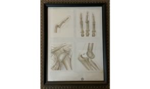 Medical Medium Framed Medical Dislocations Images 1930c