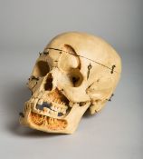 Anatomiemodel (wohl um 1900)