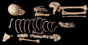 A mid 20th century medical human half skeleton, comprising skull with lower jaw, spine, sternum,