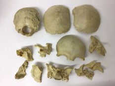 An Edwardian human skull