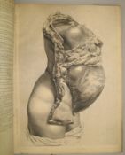 HUNTER (William) [The Anatomy of the Human Gravid Uterus exhibited in Figures] large folio,