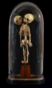 THE NATURAL HISTORY CLUB HOUSE: UNUSUAL SKELETAL MODEL CURIO OF TWO-HEADDED CHILD of stained plastic
