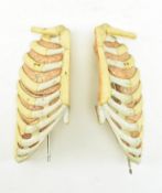 ANATOMICAL INTEREST - VINTAGE PAINTED STUDY OF LUNGS