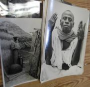 AFRICA, a group of 10 prints illustrating medical conditions of African people, photographed c.
