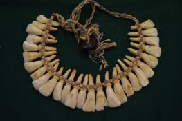 An African tooth necklace.
