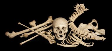 NATURAL HISTORY CLUB HOUSE: HALF MEDICAL TEACHING SKELETON (FEMALE), in a pine carrying case