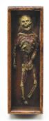 19TH CENTURY ITALIAN MEMENTO MORI / ANATOMICAL CADAVER