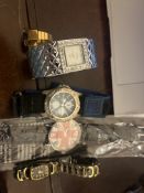 4 Watches and Watch Ring