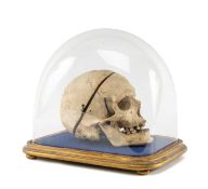 OSTEOLOGY MODEL (medical anatomical specimen), antique human skull with spring hinged jaw, two