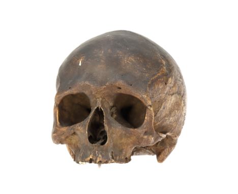 An Ancient Human Skull,mandible absent, teeth also missing apart from stump of right canine, dark patina, a small hole drille