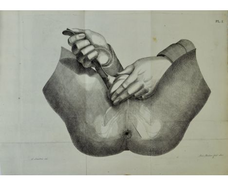 LANGENBECK, C.J.M. Eenvouwige en zekere manier van steensnijden. Met eene voorrede van Dr. J.B. Siebold. Vert. d. F.G. van In