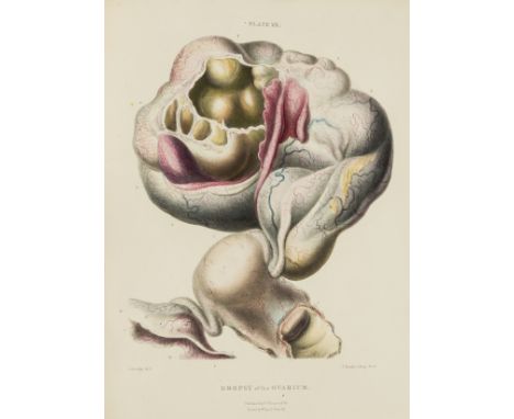 Hooper (Robert) The Morbid Anatomy of the Human Uterus and its Appendages, only edition, 22 fine hand-coloured lithographed, 