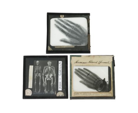 X-Rays, Two Early Magic Lantern Slides, British, c.1895-1900, a lantern slide titled 'Human hand (female) in script in ink, w