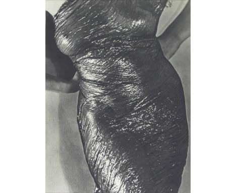 Artist: Man Ray (American, 1890 - 1976). Title: "Anatomy". Medium: Original vintage photogravure. Date: Composed 1930. Printe