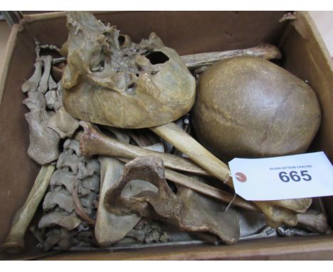  Sale Item:    SKELETON MILIKAN & LAWLEY STRAND LONDON-INCOMPLETE (AF)  Vat Status:   No Vat   Buyers Premium:  This lot is s