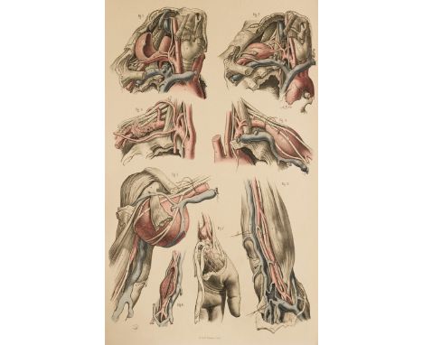 Maclise (Joseph). Surgical Anatomy, 2nd edition, London: John Churchill, 1856, 52 lithographed plates, most with hand-colouri