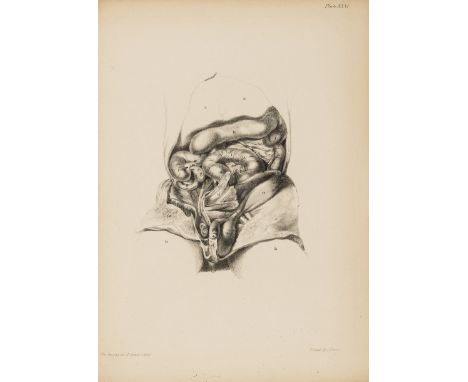 Hunter (John) The Works, 5 vol. including Atlas, vol.1 with engraved portrait, Atlas with engraved portrait and 61 plates, 7 