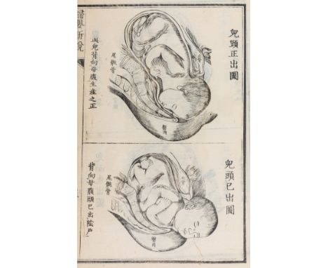 Medicine.- Obstetrics.- Hobson (Benjamin) and Guan Moacai, Fuei Shinsetsu [Manual of Gynecology, Obstetrics, and the Nursing 