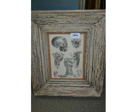 Framed 19th Century print of the human skull and another of dislocated joints and how to remedy them