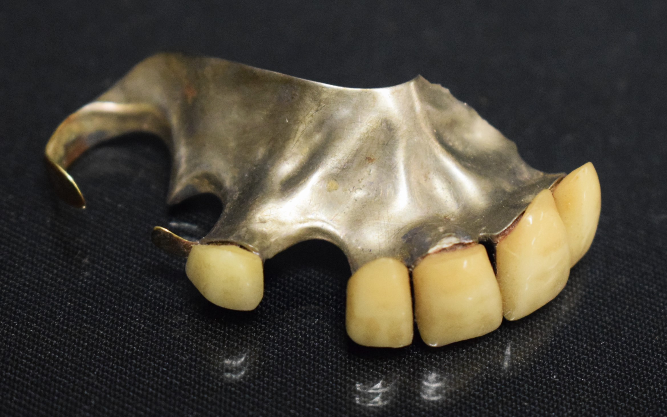 Dental interest a silver metal mounted five teeth "top plate", unmarked