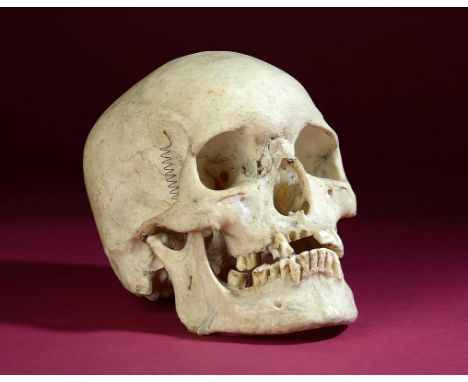 Natural History: A Human skull  hinged as a medical model 19cm.; 7½ins 