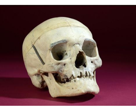 Natural History: A Human skull  hinged as a medical model 19cm.; 7½ins 